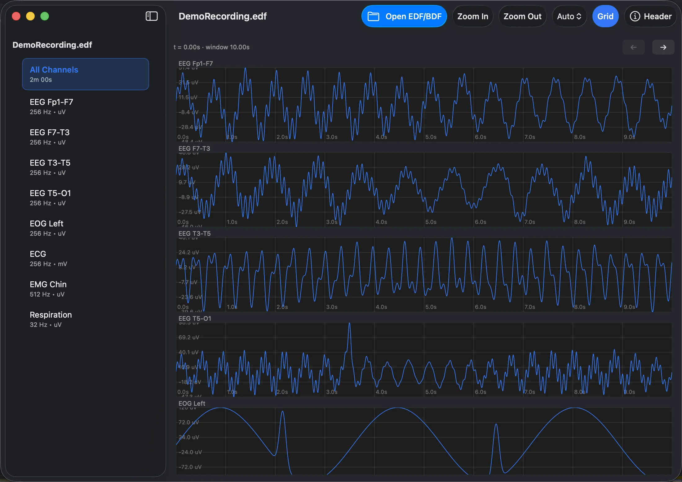 All Channels Montage and Min/Max Waveform