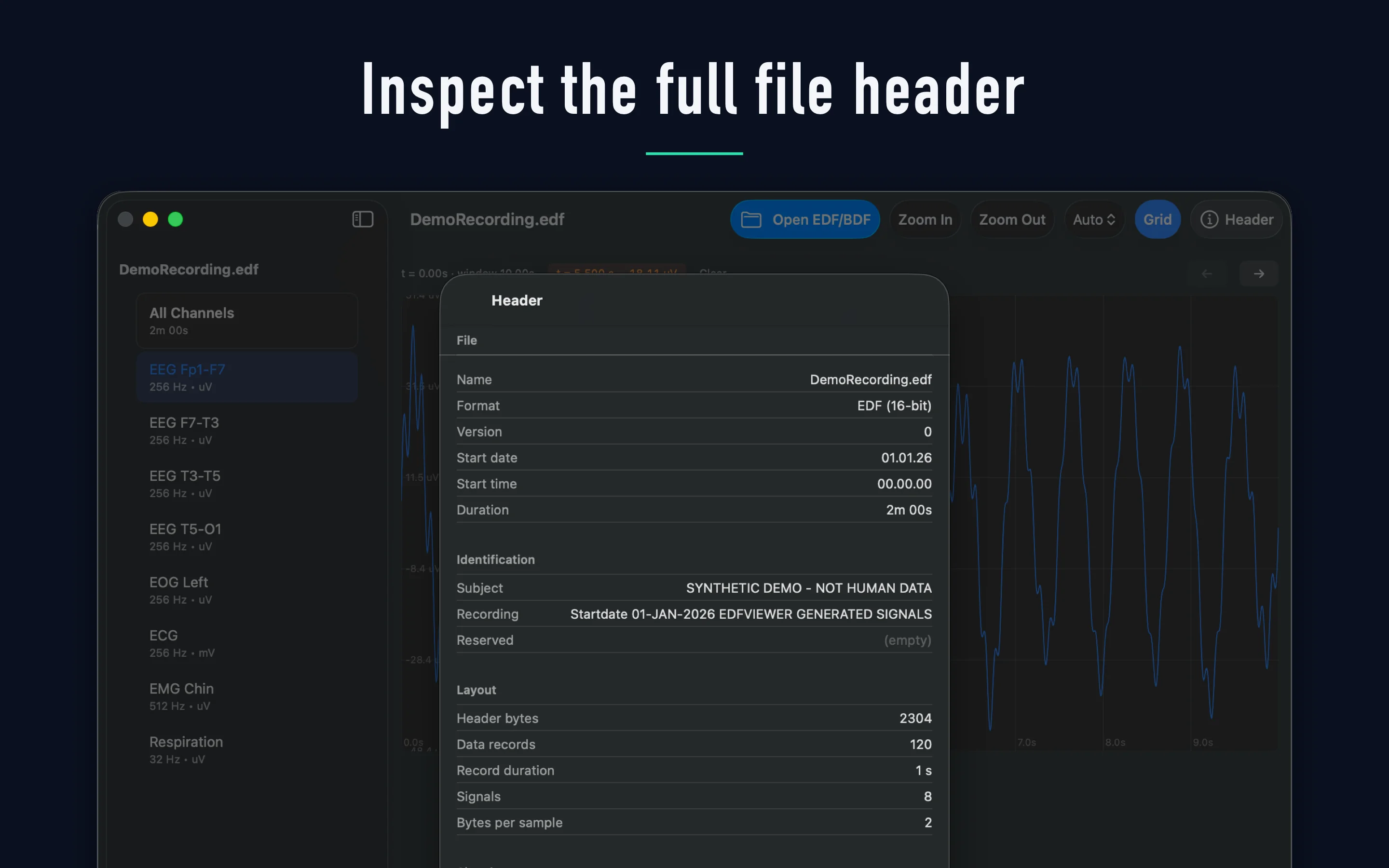 Full Header & Signal Calibration Inspector