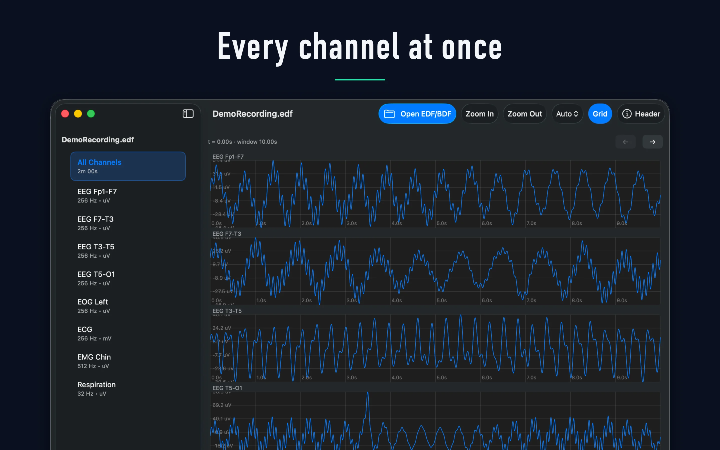 Peak-Preserving Min/Max Waveform Downsampling